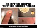 Tiny coins embedded in your flesh is a symptom of psychological distress.